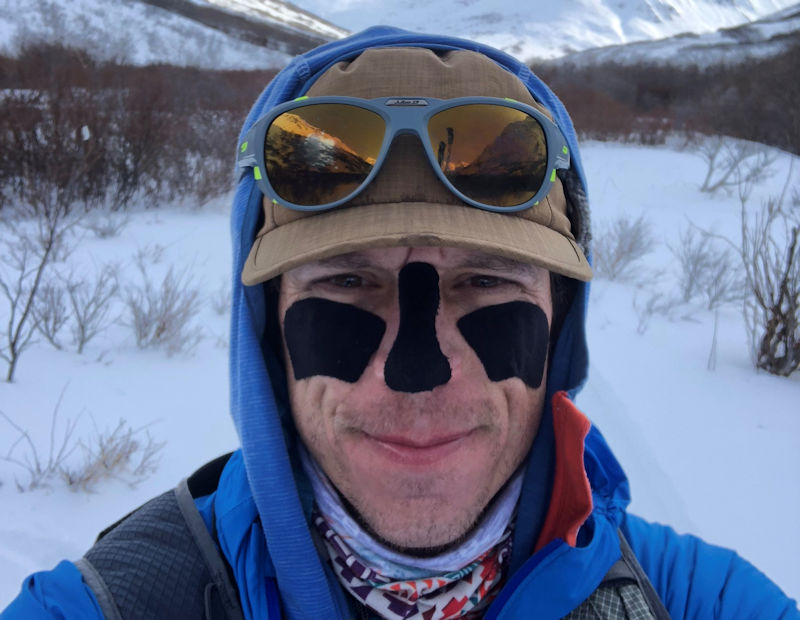 Peter Ripmaster wearing anti-frostbite tape on the Iditarod Trail